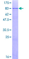 12.5% SDS-PAGE Stained with Coomassie Blue.